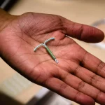 hur länge blöder man efter insättning av hormonspiral